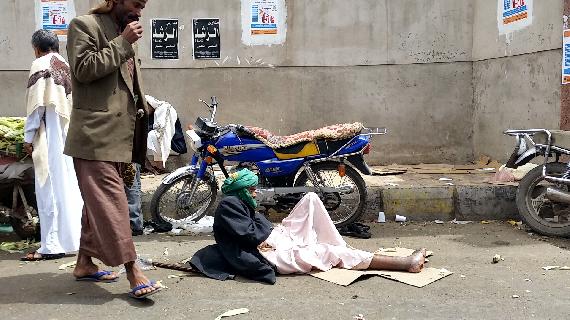 A man with a foot illness is laying in front of Al-Thawra Hospital begging passers-by for money, most of the times he is ignored. (Photogrpher: Yasser Mohammed Rayes)